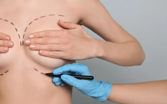 Cirurgia mamária na Bívar Clinic Lisboa — aumento, redução e mastopexia
